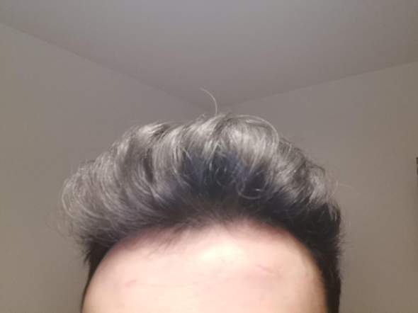 haare haarpflege haarausfall