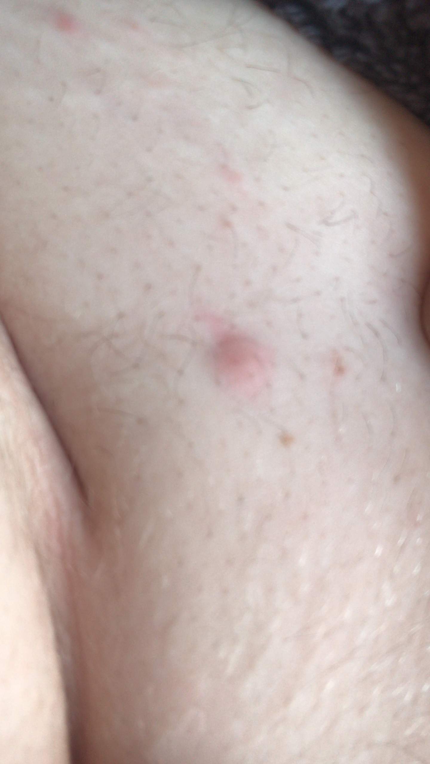 Habe Ich Mich Mit Aids Infiziert Gesundheit Und Medizin Krank Hiv Habe Ich Mich Mit Aids Infiziert Gesundheit Und Medizin Krank Hiv