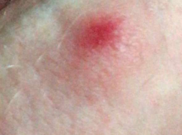 Habe Ich Mich Mit Aids Infiziert Gesundheit Und Medizin Krank Hiv Habe Ich Mich Mit Aids Infiziert Gesundheit Und Medizin Krank Hiv