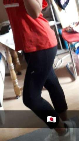 Habe Ich Reiterhosen Bzw Diese Lipodem Krankheit Gesundheit Und Medizin Madchen