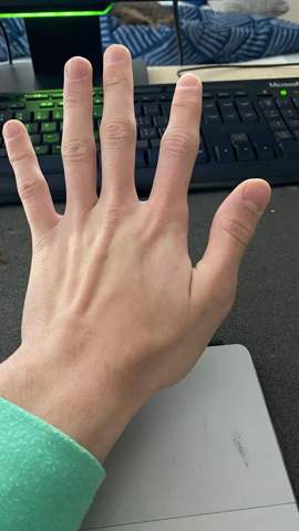 Habe ich schöne Hände?