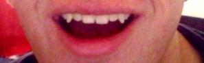 Habe ich wirklich Vampir Zähne?