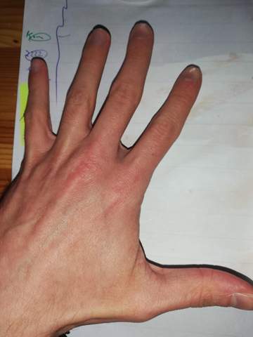 Habe Ich Zu Weibliche Hande Bzw Finger Liebe Gesundheit Und Medizin Liebe Und Beziehung Madchen