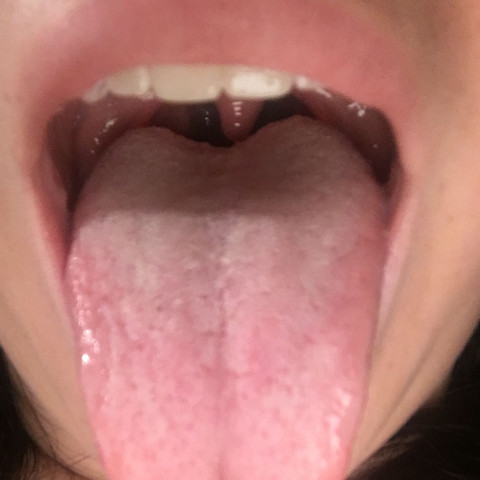 Sehe die weissliche Zunge - (Pilze, Zunge, zungenpilz)