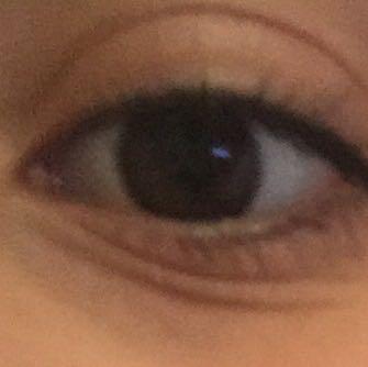 Guckt :(( - (Augen, Falten)