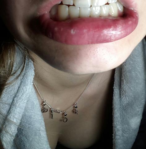 Habe So Komische Blaschen In Der Unterlippen Innenseite Gesundheit Lippe