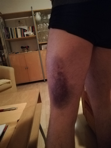 - (Gesundheit, Boxen, Kampfsport)