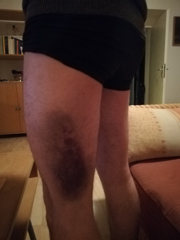 - (Gesundheit, Boxen, Kampfsport)