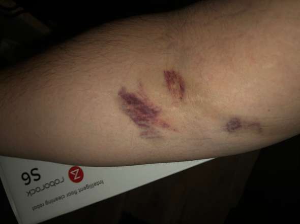 Hamatom Die Meistgelesenen Fragen Hamatom Die Meistgelesenen Fragen