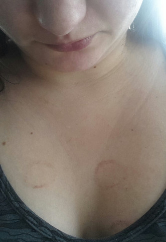 Hamatom Die Meistgelesenen Fragen Hamatom Die Meistgelesenen Fragen