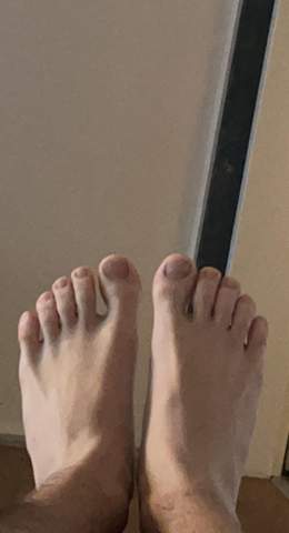 Hässliche Füße?
