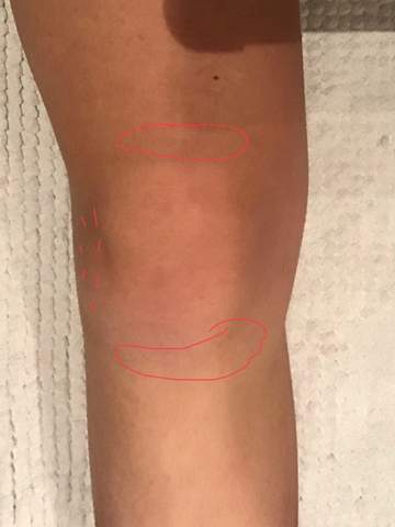 Haufige Knieschmerzen Ohne Grund Gesundheit Und Medizin