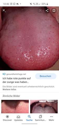 Hallo, habe seit heute solche Blschen im Mund und mach mir ein wenig Sorgen. Es brennt nix und tut auch nix weh was kann es sein? (Zunge, rote-punkte) Hallo, habe seit heute solche Blschen im Mund und mach mir ein wenig Sorgen. Es brennt nix und tut auch nix weh was kann es sein? (Zunge, rote-punkte)
