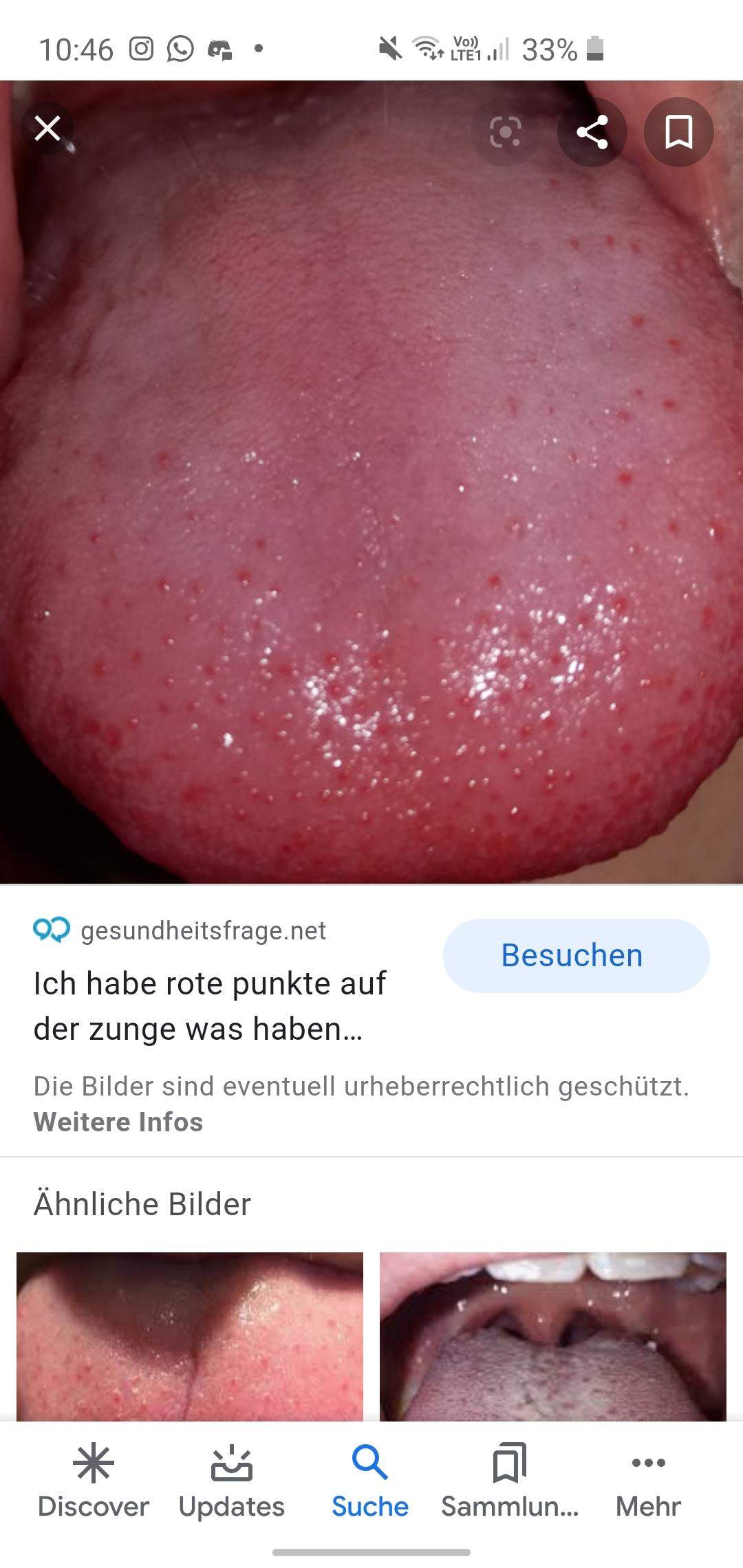 Hallo, habe seit heute solche Bläschen im Mund und mach mir ein wenig Es brennt nix und