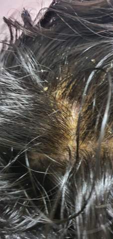 stelle die haut gelb ist und die haare