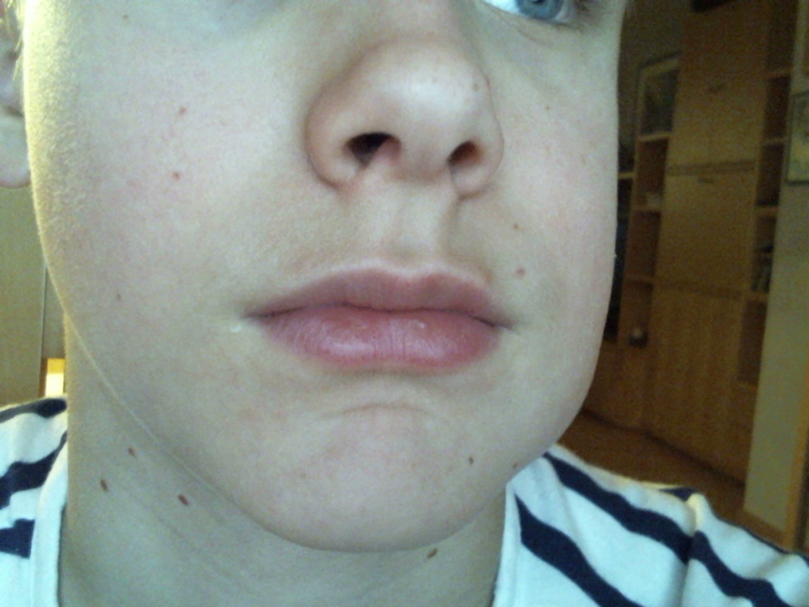 Hallo Ich Habe Meine Weisheitszahne Ziehen Lassen Und Nun Ist Es Geschwollen Wie Kriege Ich Es Weg Gesundheit Schwellung Hallo Ich Habe Meine Weisheitszahne Ziehen Lassen Und Nun Ist Es Geschwollen Wie Kriege Ich Es Weg Gesundheit Schwellung