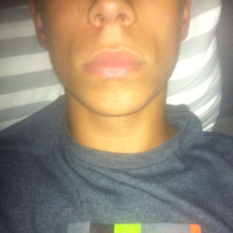 Hallo Ich Habe Seit Einiger Zeit Komische Falten An Den Mundwinkeln Und Wollte Fragen Wie Ich Die Wieder Los Werden Kann Gesicht Mundwinkel