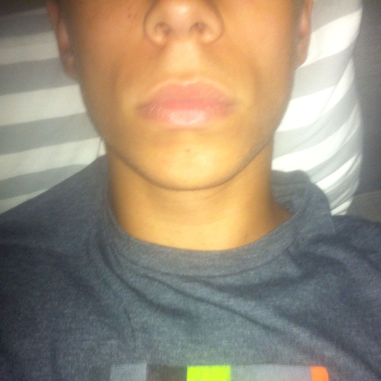 Hallo Ich Habe Seit Einiger Zeit Komische Falten An Den Mundwinkeln Und Wollte Fragen Wie Ich Die Wieder Los Werden Kann Gesicht Mundwinkel