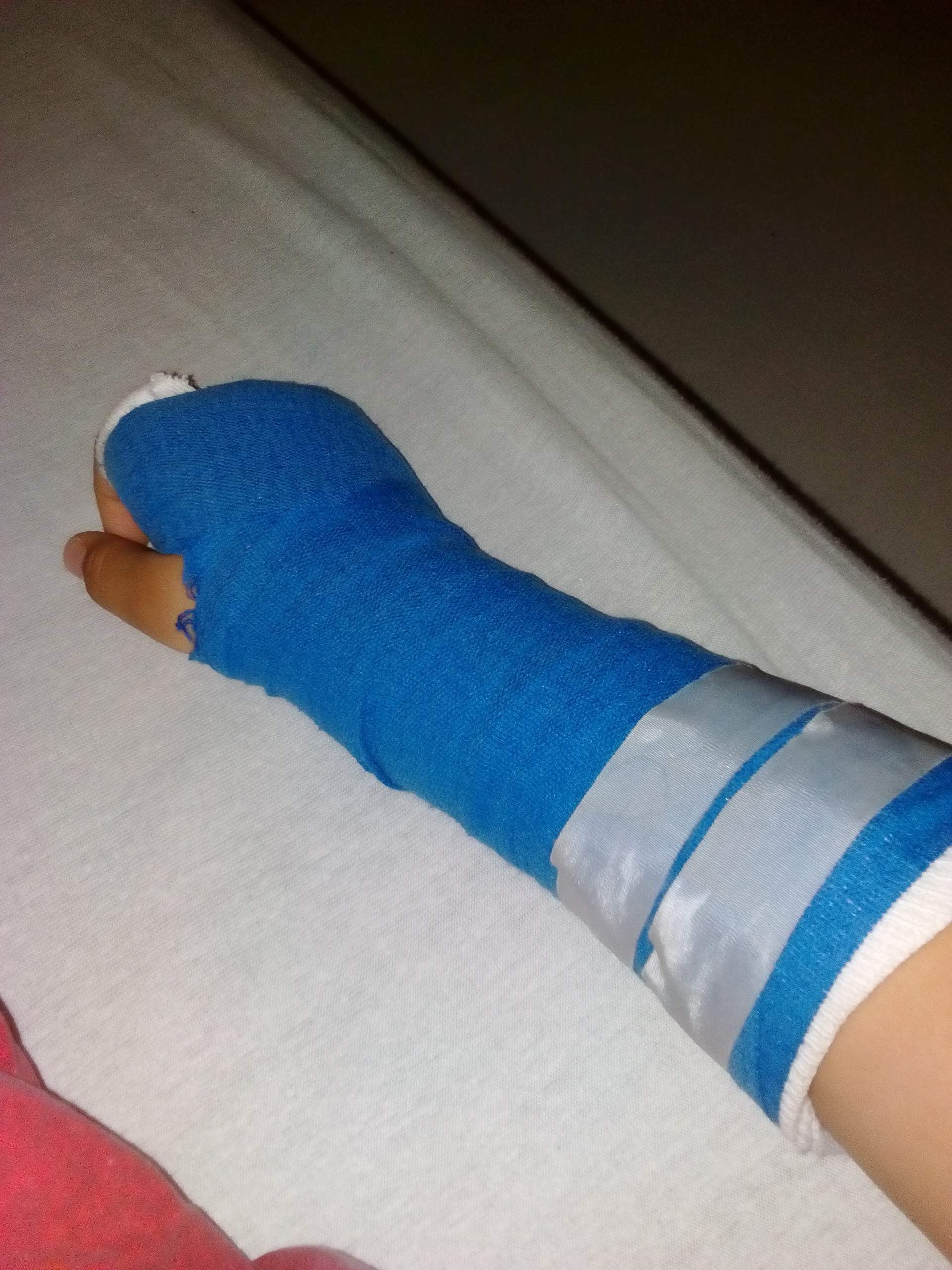 Hallo ich habe vor einer Woche mir denn arm gebrochen und kann ihn