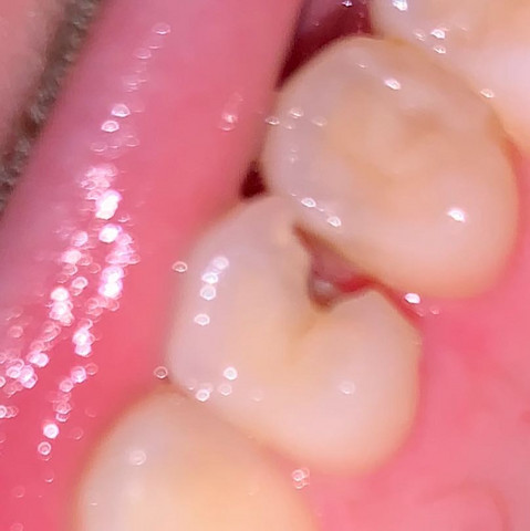 Zahn von unten  - (Arzt, Zähne, Zahnmedizin)