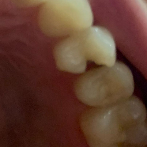 Zahn von unten  - (Arzt, Zähne, Zahnmedizin)