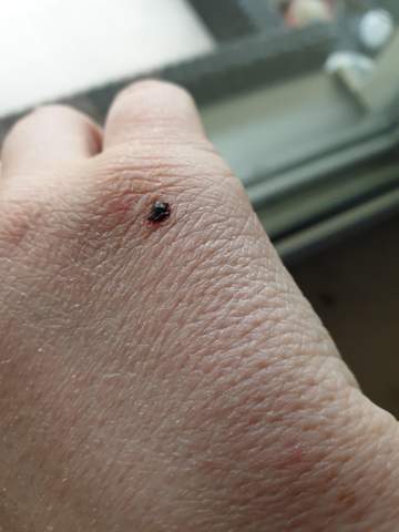 Schwarzer Fleck Die Meistgelesenen Fragen Schwarzer Fleck Die Meistgelesenen Fragen