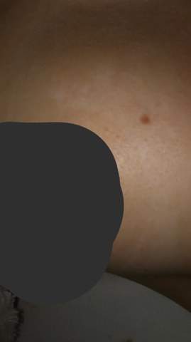 Hallo Weisse Ringe Um Die Brust Gesundheit Und Medizin Ring Hallo Weisse Ringe Um Die Brust Gesundheit Und Medizin Ring