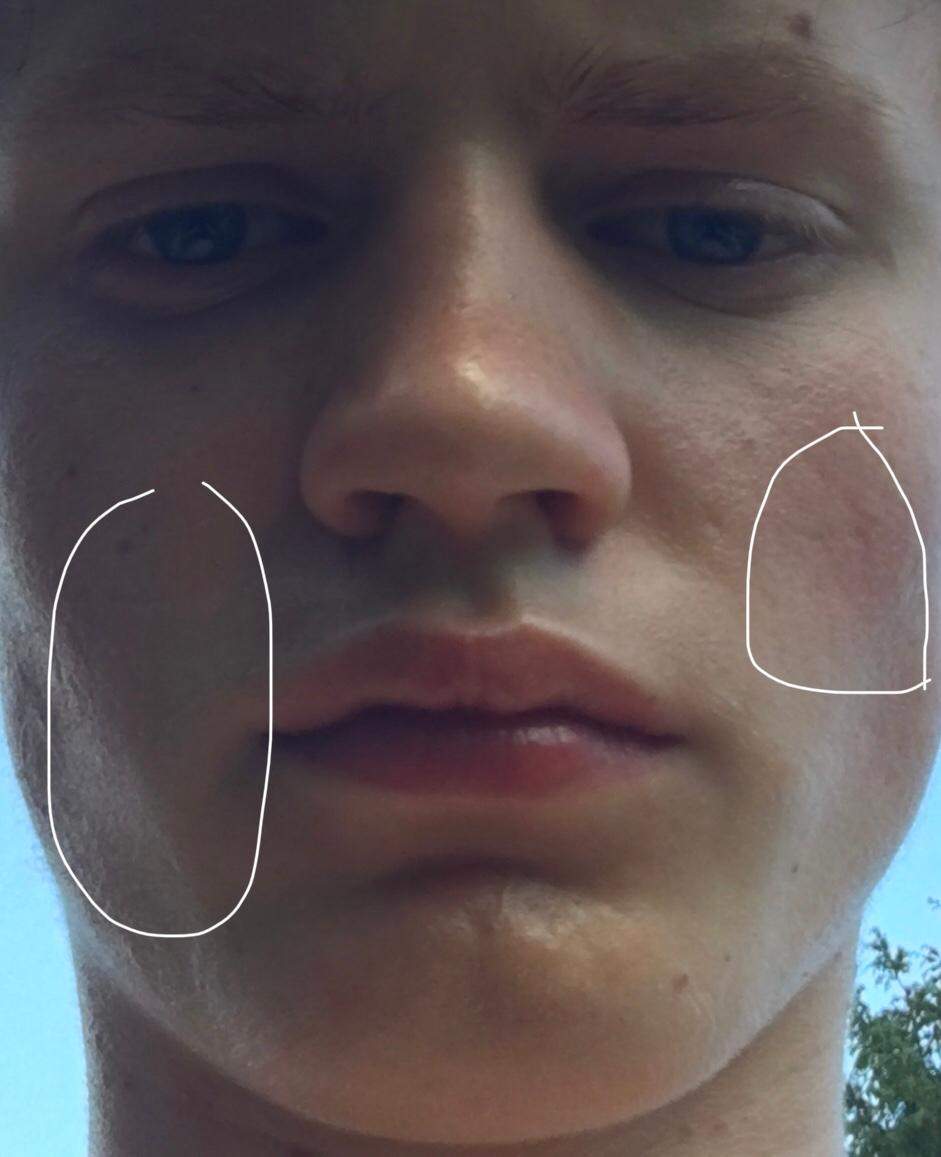 Hallo Wie Bekomme Ich Reine Haut Gesundheit Und Medizin Beauty Gesicht Hallo Wie Bekomme Ich Reine Haut Gesundheit Und Medizin Beauty Gesicht