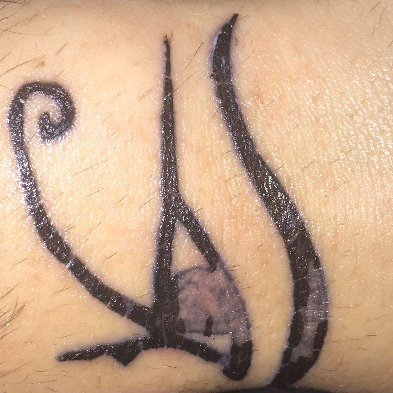 Hallo zusammen habe eine kleine Frage und zwar mein tattoo (Haut)