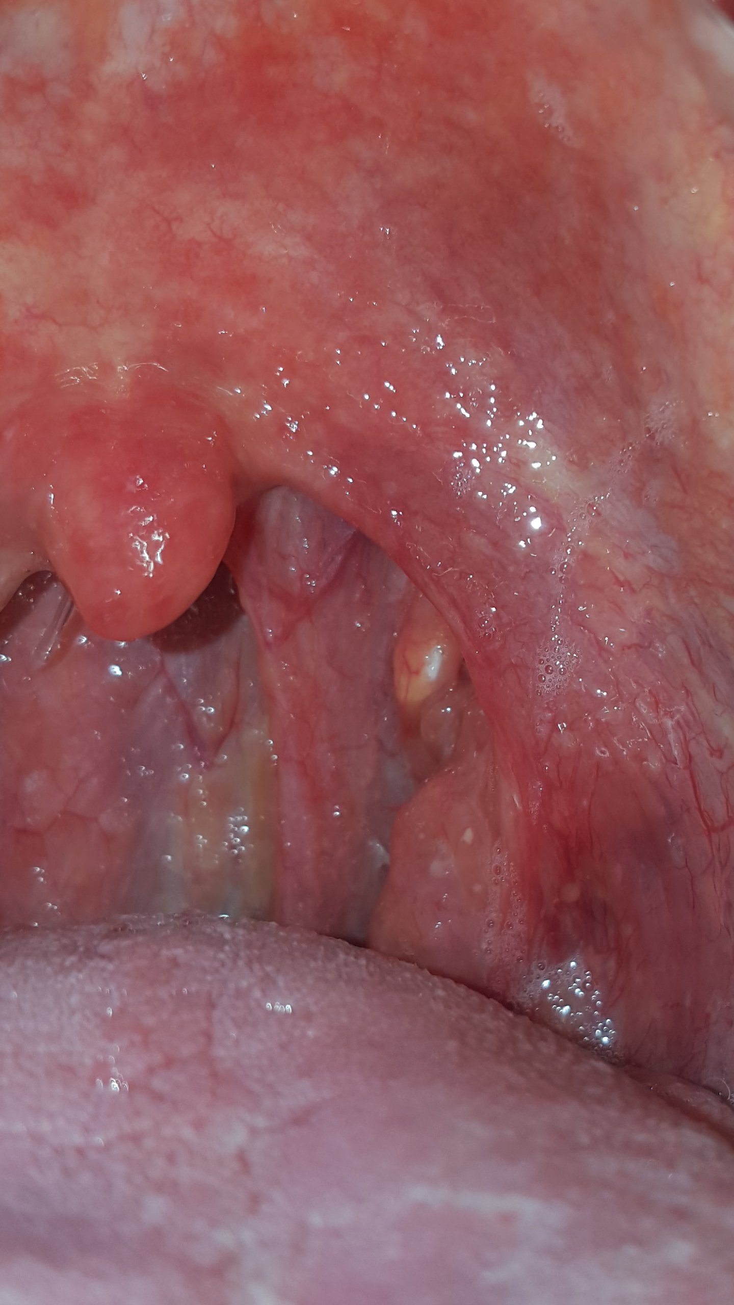 Hallo, ich hatte vorhin beim Schlucken einen leichten Schmerz im Hals Hallo, ich hatte vorhin beim Schlucken einen leichten Schmerz im Hals