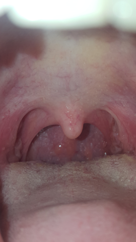 Halsschmerzen Hilfeeeeeee Gesundheit Und Medizin Krank Hausmittel Halsschmerzen Hilfeeeeeee Gesundheit Und Medizin Krank Hausmittel