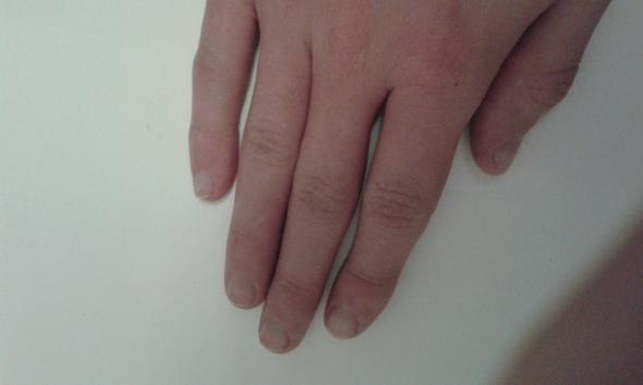 21 - (Körper, Hand)