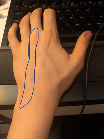 Hand Krampf Beim Zocken Pc Gesundheit Gaming Hand Krampf Beim Zocken Pc Gesundheit Gaming