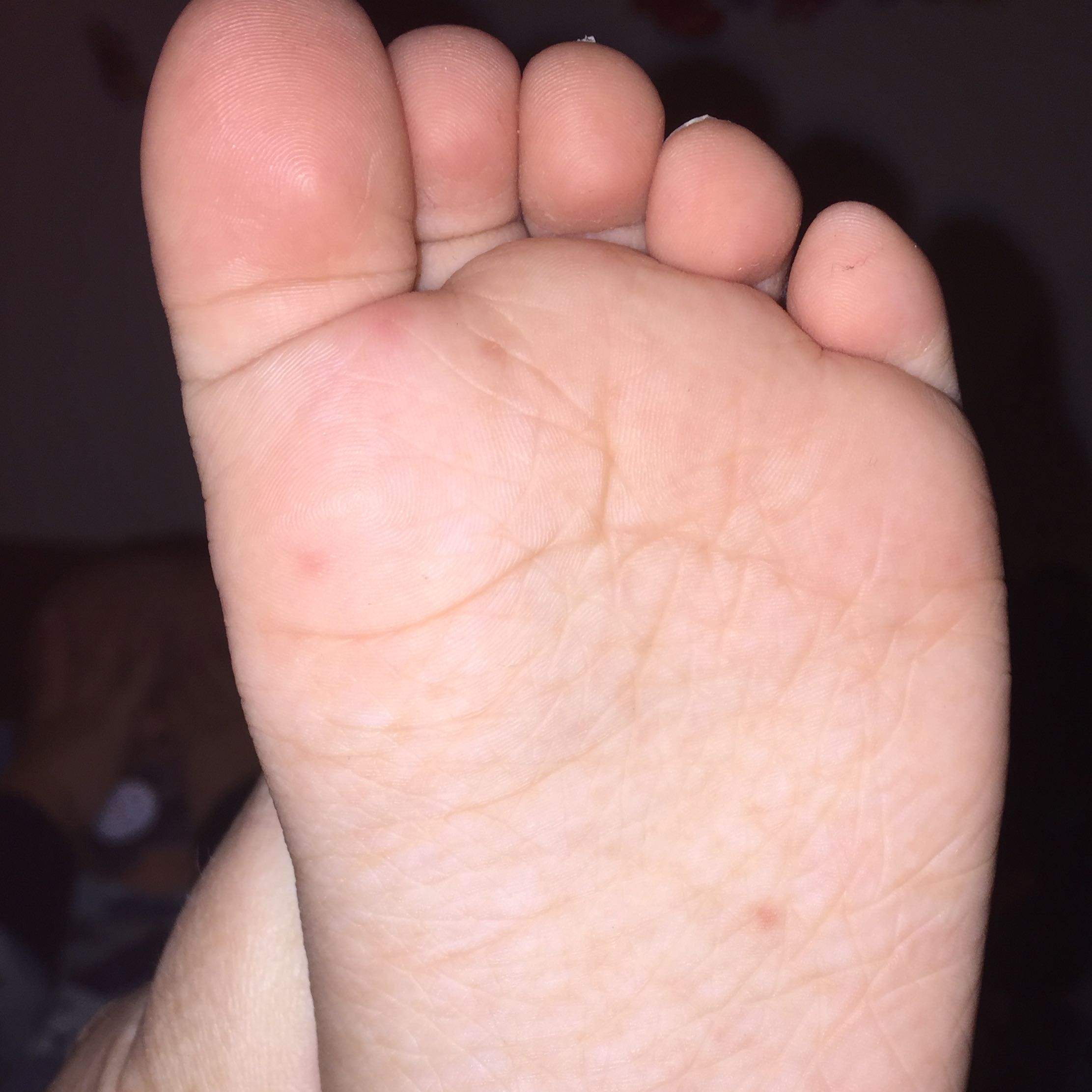 Hand Mund Fuss Hand Mund Fuss