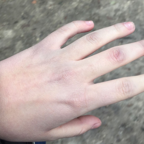 Da sieht man es aber in echt sieht man es noch stärker - (Hand, weiss, grün)