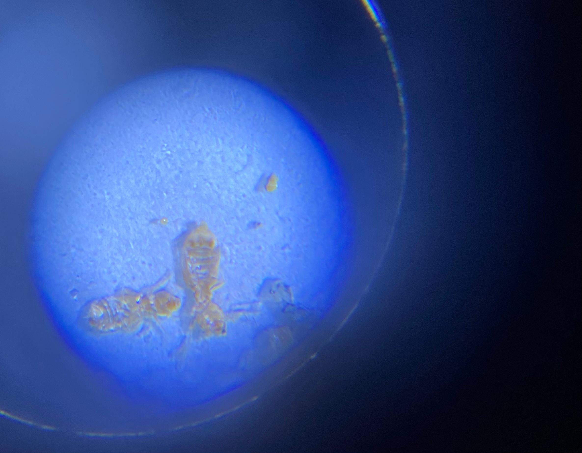 Handelt es sich um Bettwanzen? (Insekten, Schädlinge, Ungeziefer)