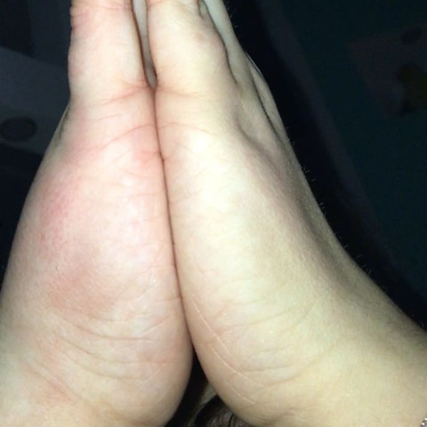 Also das ist der Vergleich😄 - (Arzt, Schmerzen, Hand)