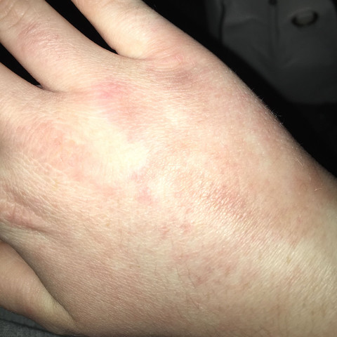 Und hier einmal von vorne - (Arzt, Schmerzen, Hand)
