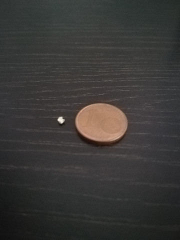 Harnleiterstein Im Urin Trotz Harnleiterschiene Gesundheit Arzt Krankenhaus Harnleiterstein Im Urin Trotz Harnleiterschiene Gesundheit Arzt Krankenhaus