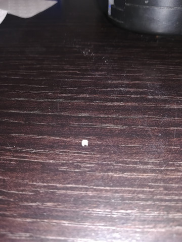 Harnleiterstein Im Urin Trotz Harnleiterschiene Gesundheit Arzt Krankenhaus Harnleiterstein Im Urin Trotz Harnleiterschiene Gesundheit Arzt Krankenhaus