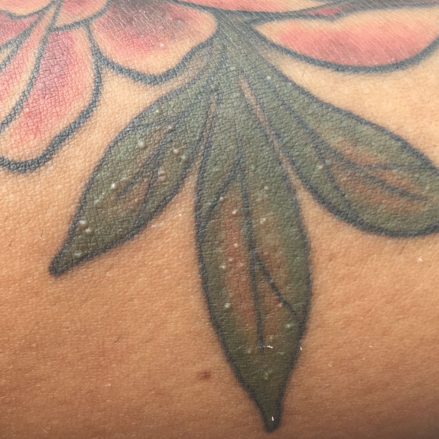 Harte weiße Hubbel im Tattoo? (Gesundheit und Medizin, Haut, Pickel)