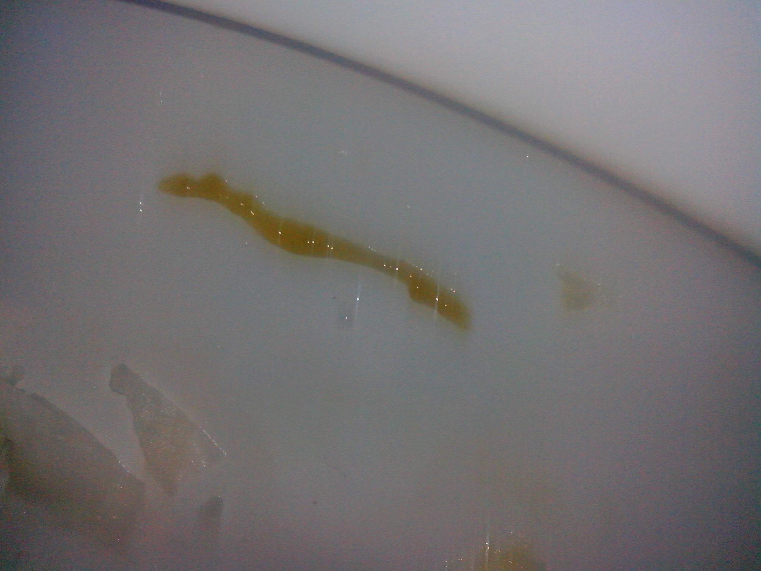 harter bauch, wurmbefall, candida pilz, stuhlprobleme, darmprobleme, magendarm (Magen, Darm