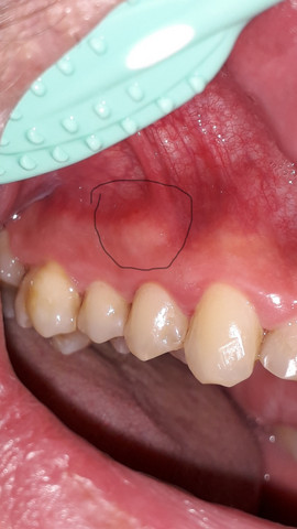 Zahnfleisch Die Meistgelesenen Fragen Zahnfleisch Die Meistgelesenen Fragen