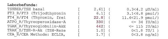 Hashimoto Gesundheit Schilddruse Hashimoto Thyreoiditis Hashimoto Gesundheit Schilddruse Hashimoto Thyreoiditis