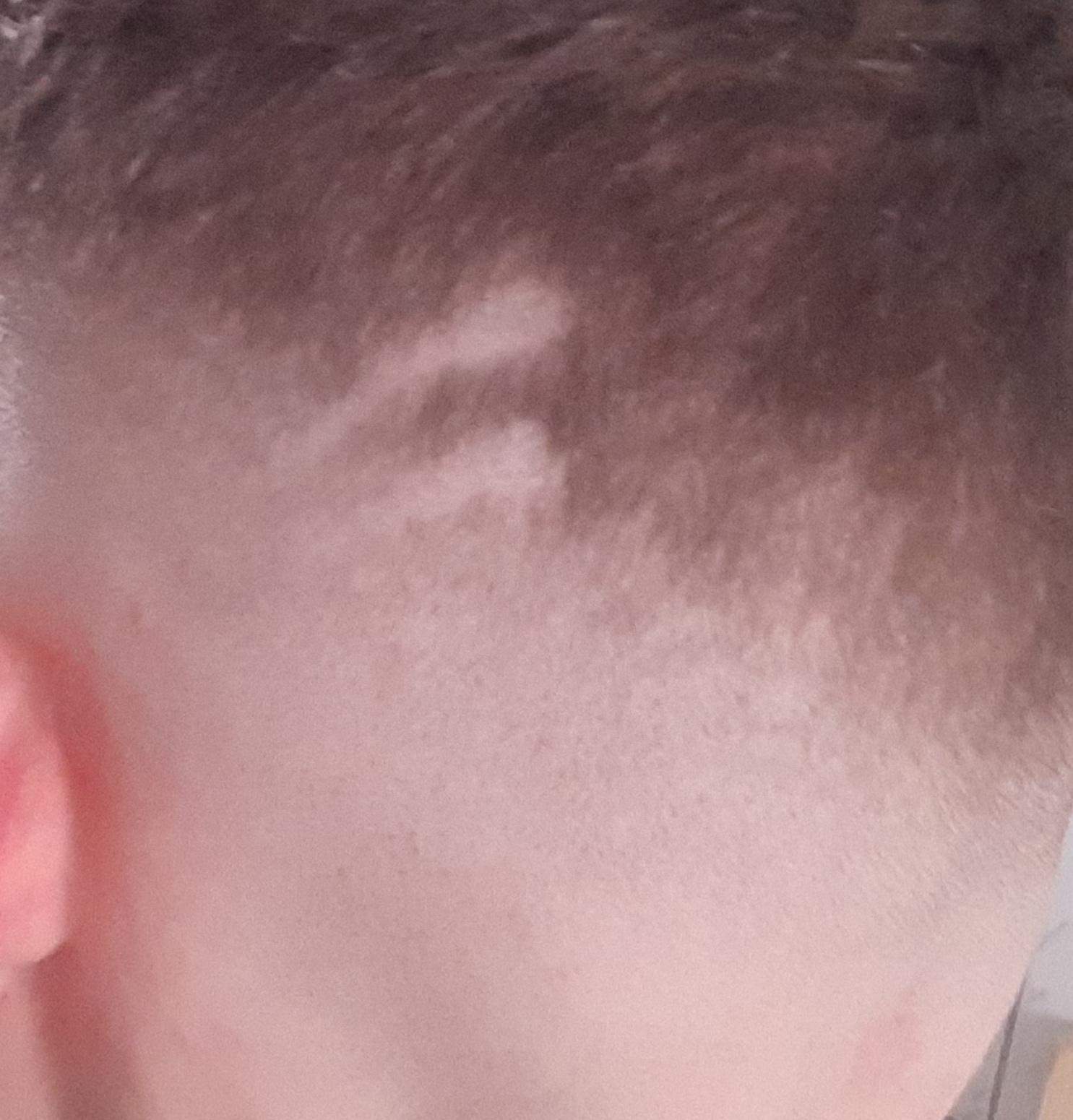 Hat der die striche verkackt? (Männer, Jungs, Aussehen)