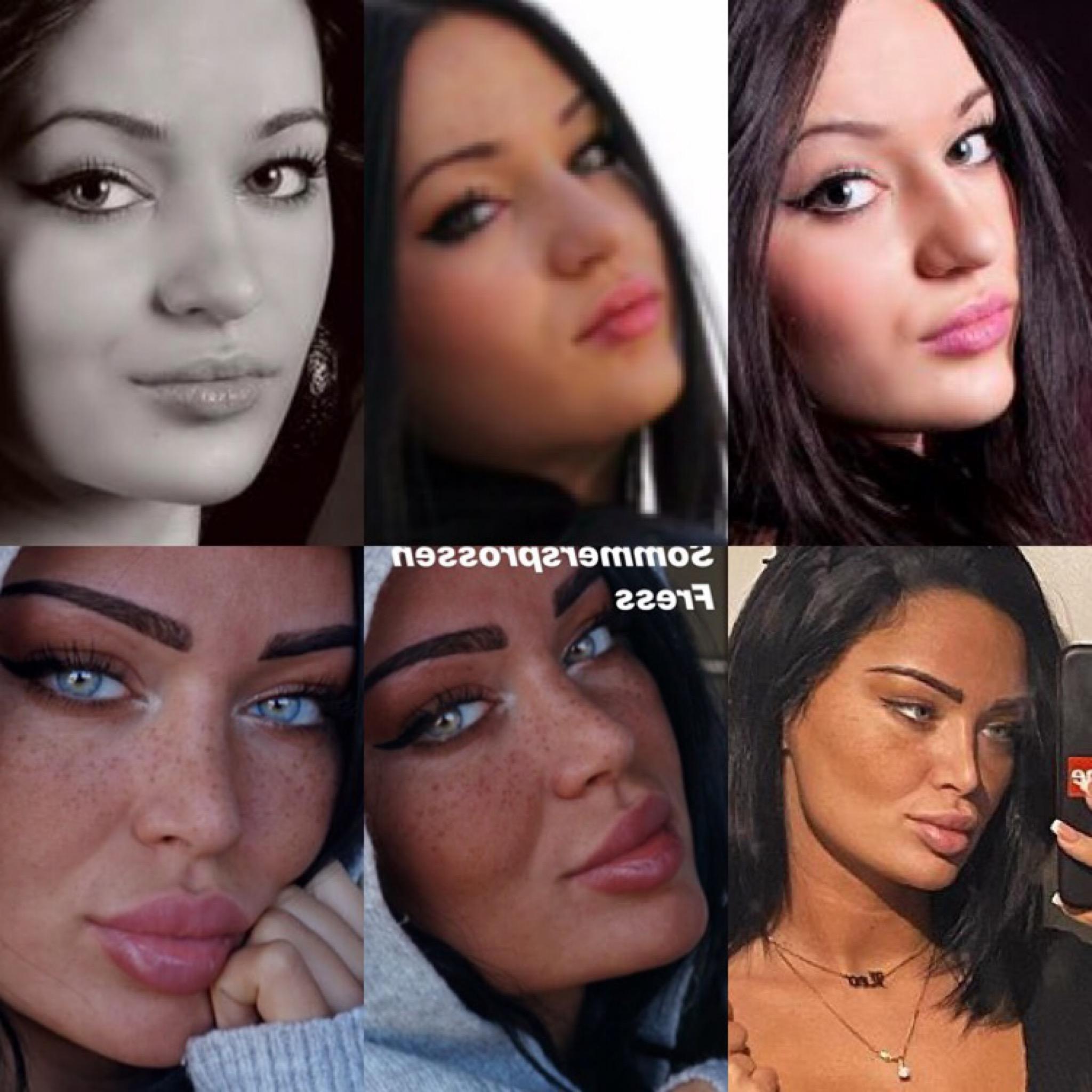 Hat Sich Die Frau Auf Dem Bild Ihre Nase Ihre Lippen Machen Lassen Frauen Beauty Instagram