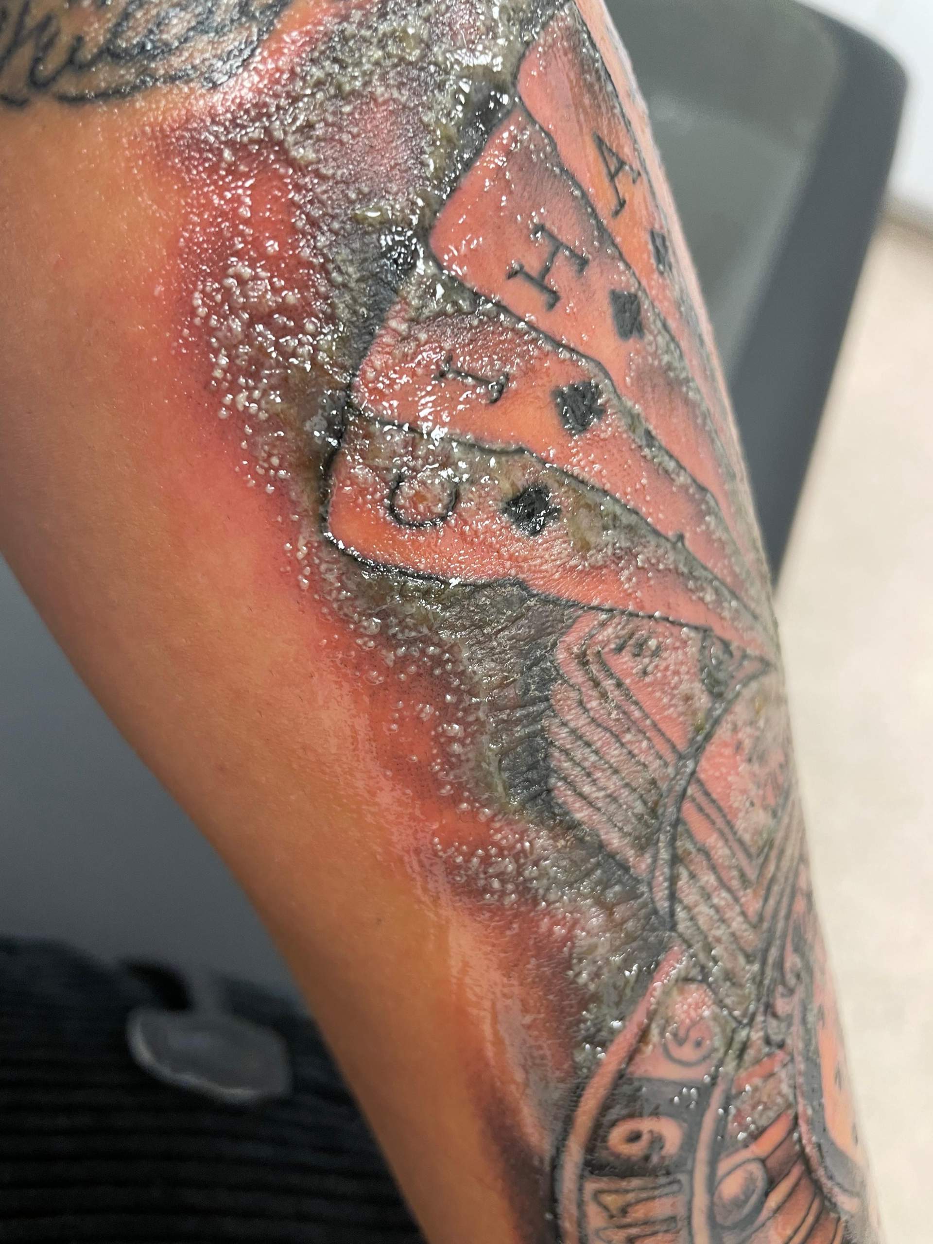 Hat sich mein tattoo schlimm entzündet bzw bleibt die Farbe