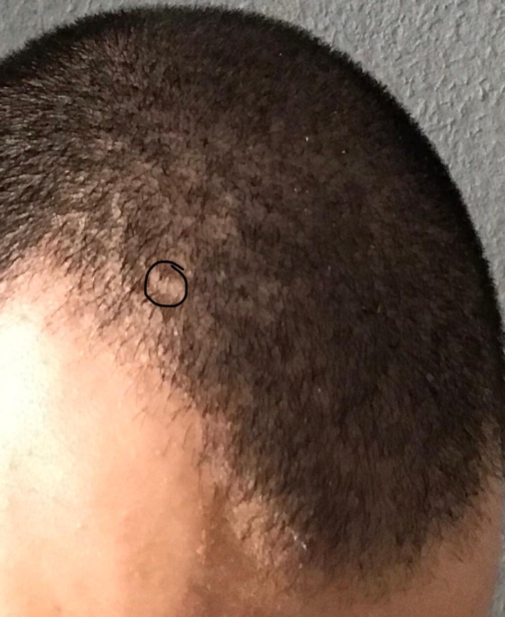 hatte vor knapp 2 wochen meine haare