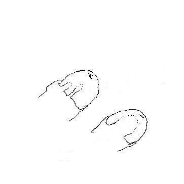 Penis beschnittener Steifer beschnittener