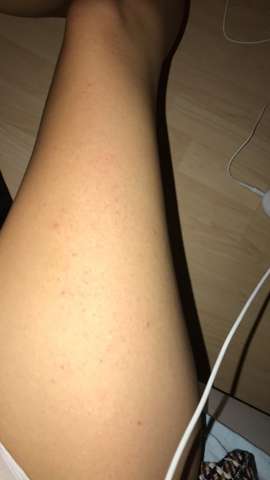 haut mit epilieren zerstort rasieren